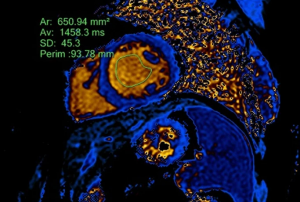 CMR measurement