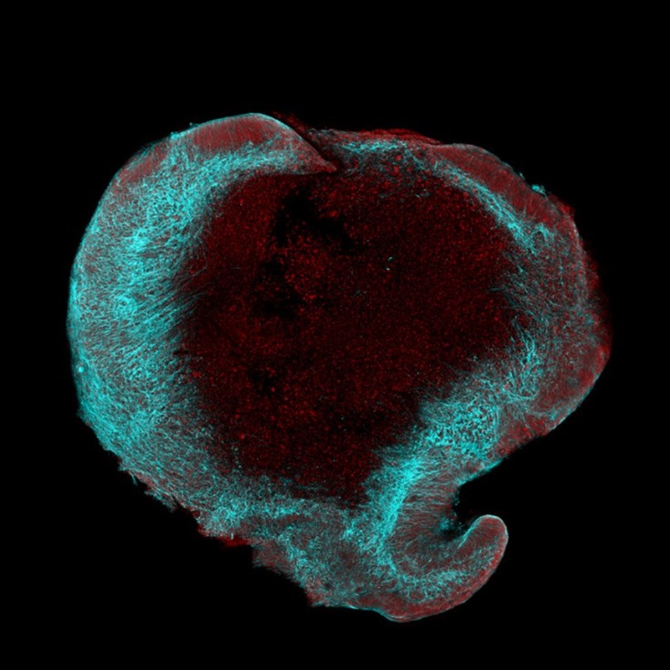 Photo: Microscopic image of a brain organoid